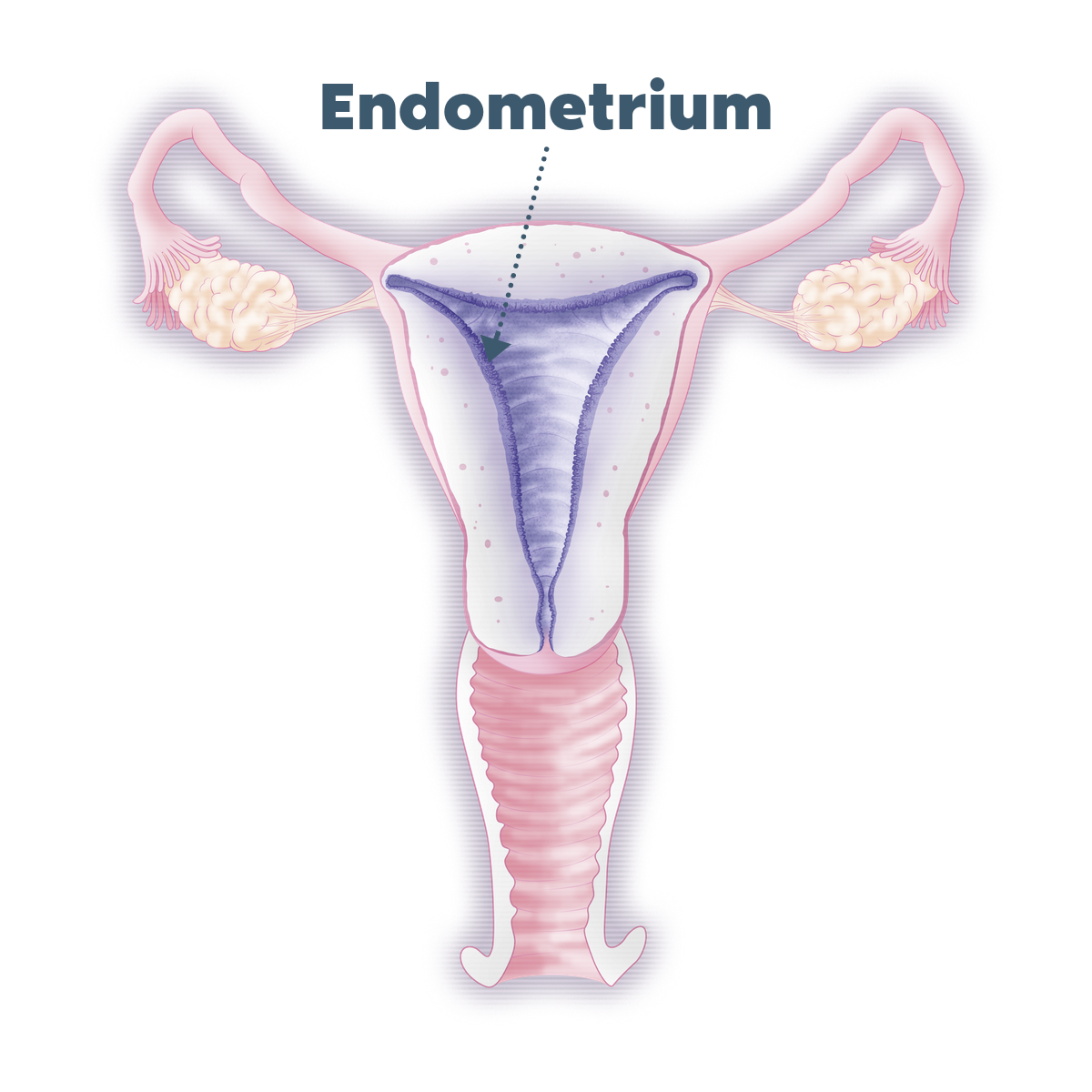 ERA® Endometrial Receptivity Analysis